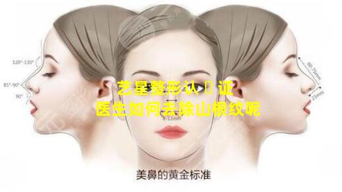 艺星整形认 ☘ 证医生如何去除山根纹呢
